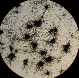 Chaetomium globosum kommt weltweit im Boden vor und lebt von pflanzlichen Rückständen Er gehört zu den holzzerstörenden Moderfäulepilzen.